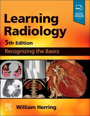 Learning Radiology: Recognizing the Basics Paperback Elsevier
